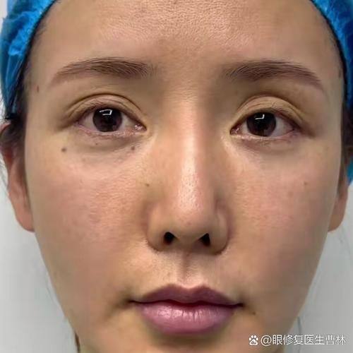 深圳心悦整形医疗美容门诊部预约挂号方式：