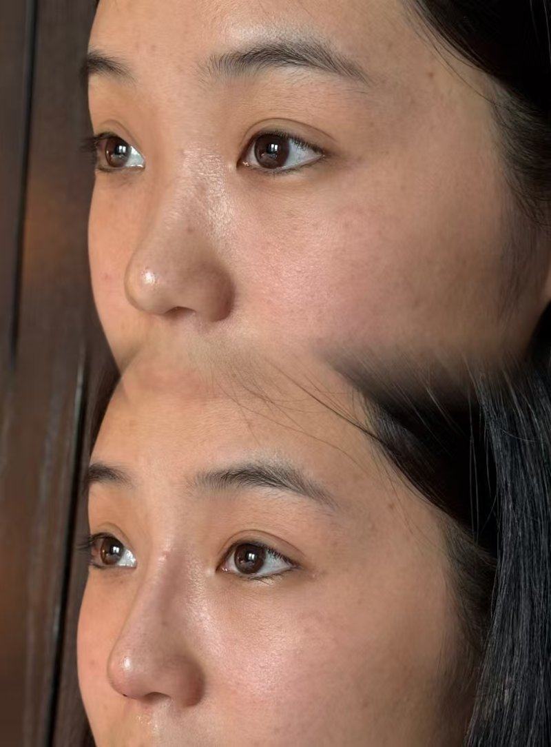 河南开封时光整形擅长项目：