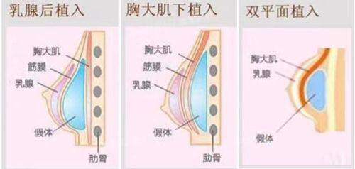 李昌斌医生擅长领域：