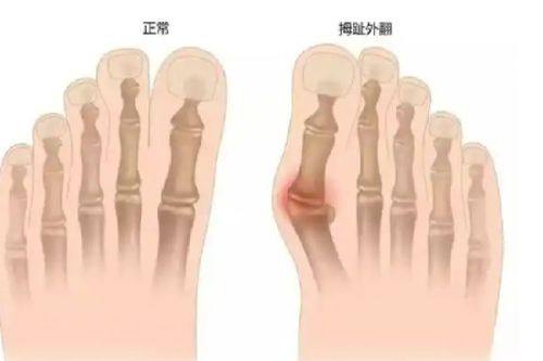 任忠亮医生技术优势：