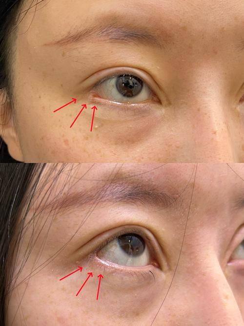 邳州市人民医院烧伤整形美容科价格表：