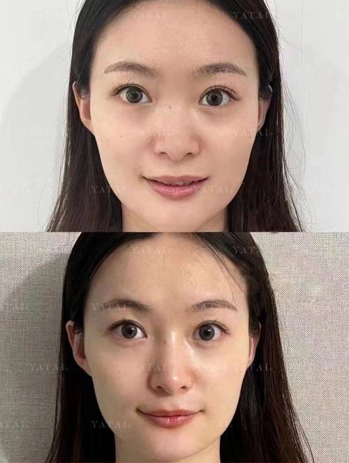 常州博仕美容整形门诊部擅长项目