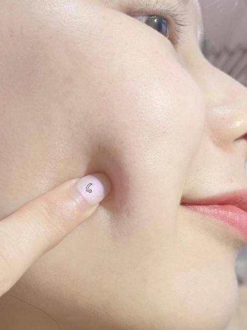 芜湖壹加壹整形医院预约挂号方式