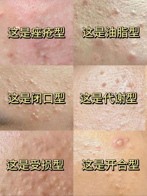 崔敬喜医生技术优势：