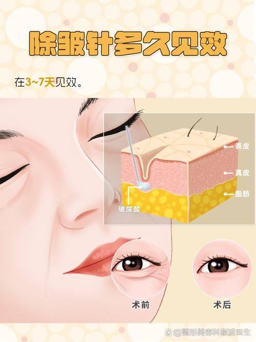 嘉兴昕欣然医疗美容门诊部擅长项目