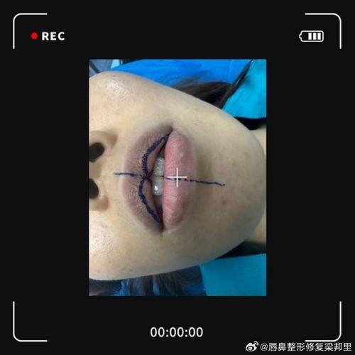 常州博仕美容整形门诊部口碑评价