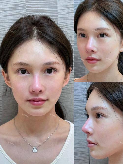 广州美贝尔整形医院地址电话及营业时间：