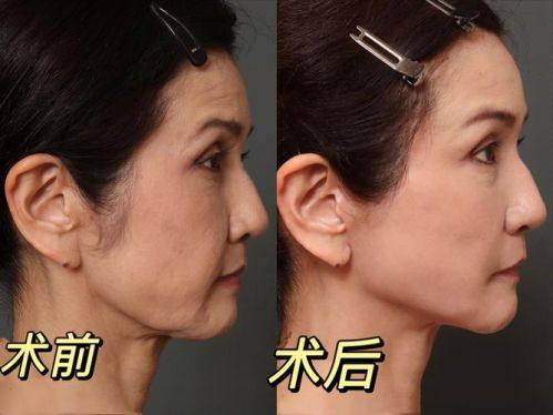 芜湖壹加壹整形医院地址电话及营业时间