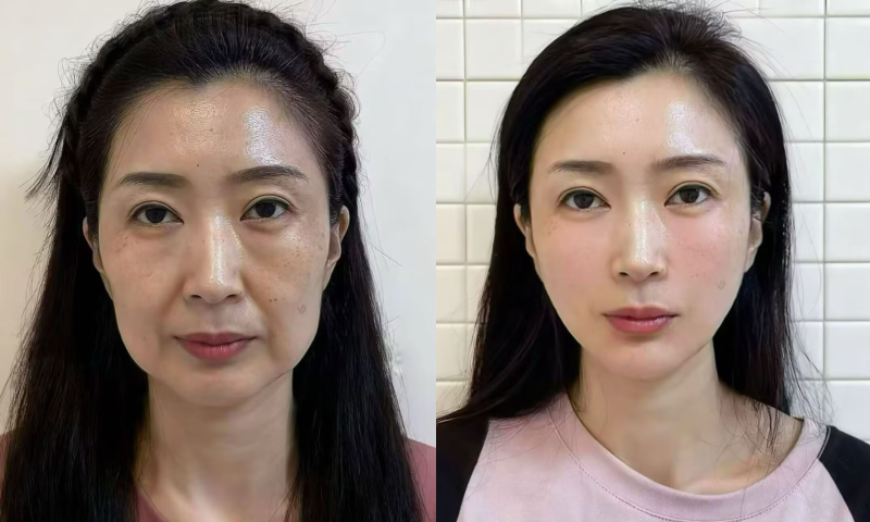 三、特殊修复情况的修复周期