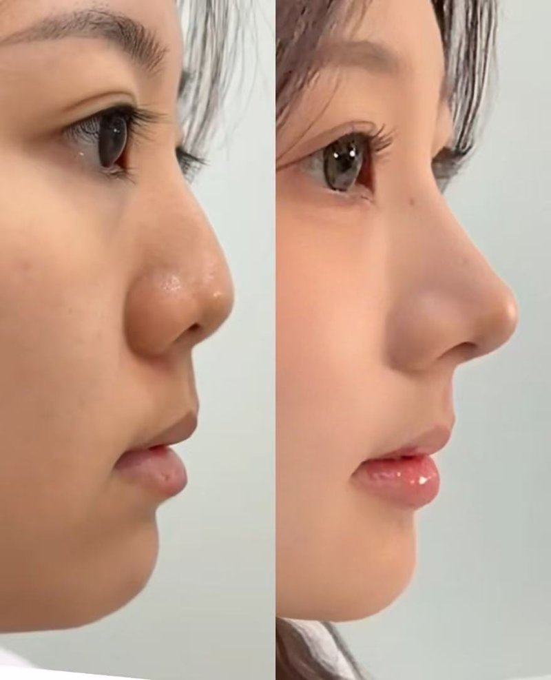 邳州市人民医院烧伤整形美容科擅长项目：