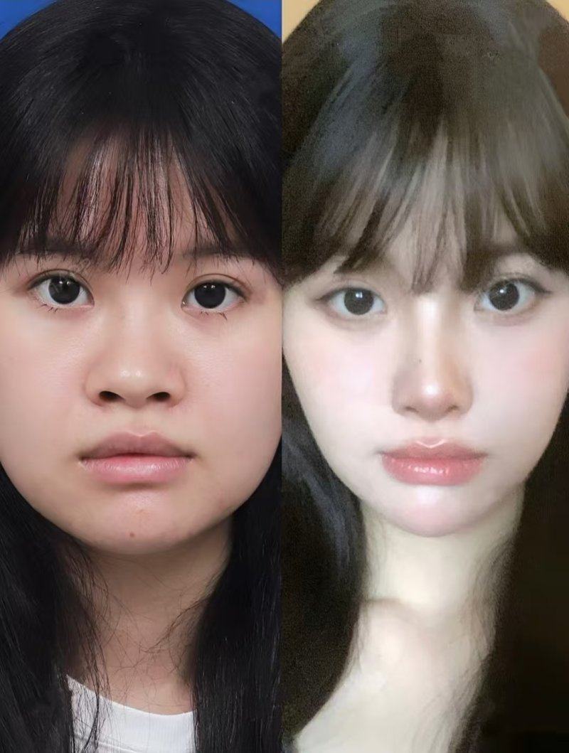 韩国Themoon整形医院预约挂号方式