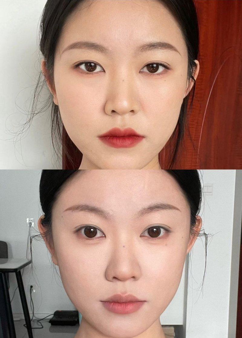 郑绍埏医生口碑评价：