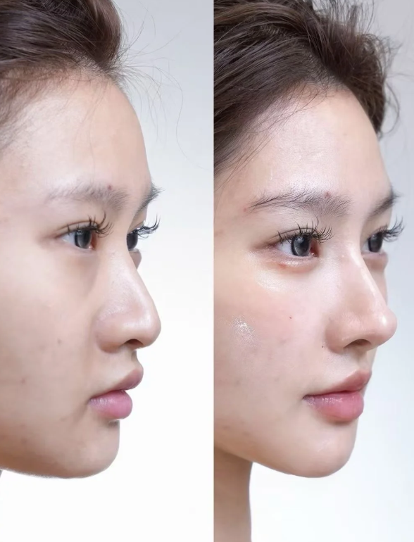 比丽普整形外科怎么样？