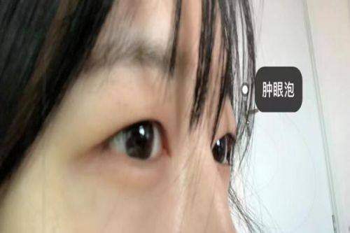 仙台Eye美容外科怎么样？