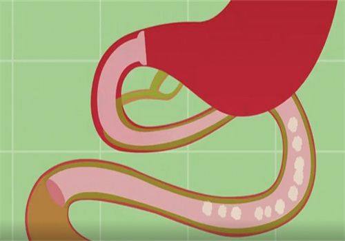 四、怎么修复手术疤痕好得快？这些细节不能忽略