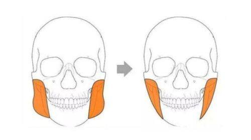 五、隆鼻后用热毛巾敷的正确操作步骤