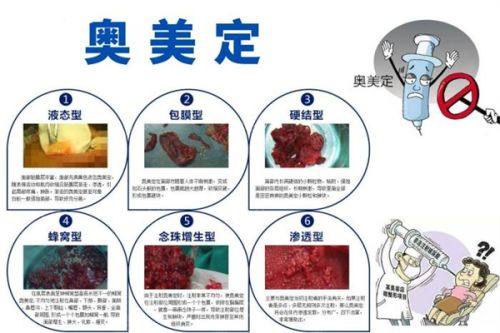 三、眼袋大还有黑眼圈的实用改善调理方法
