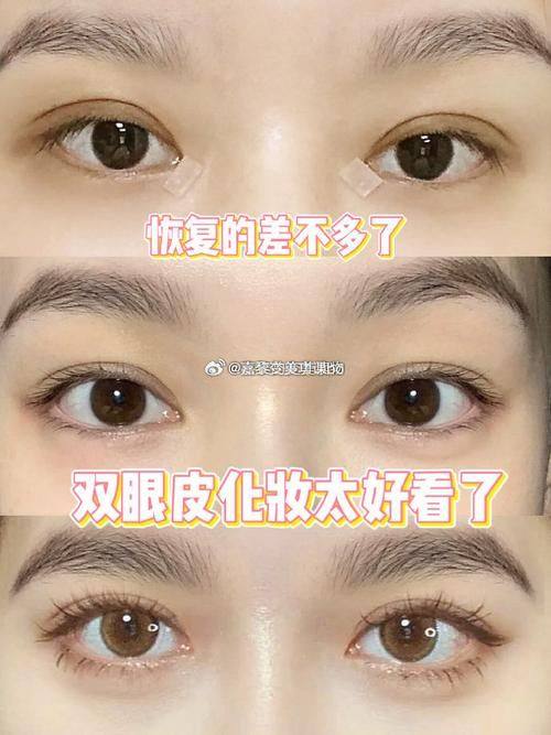 仙台Eye美容外科预约挂号方式