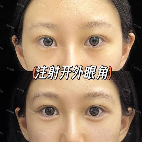 仙台Eye美容外科擅长项目