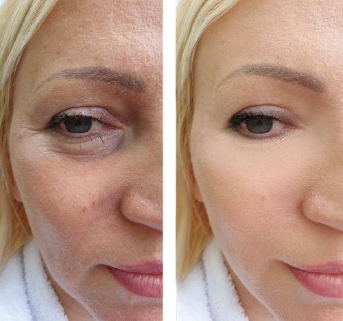 仙台Eye美容外科价格表