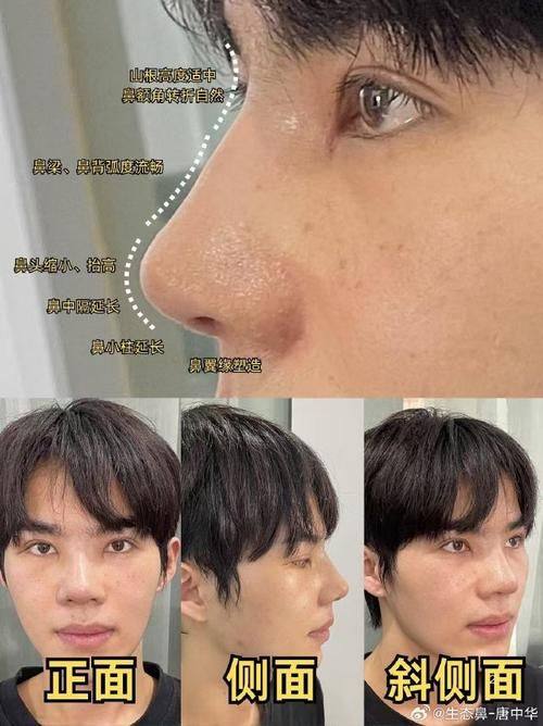 李星爱医生擅长领域：