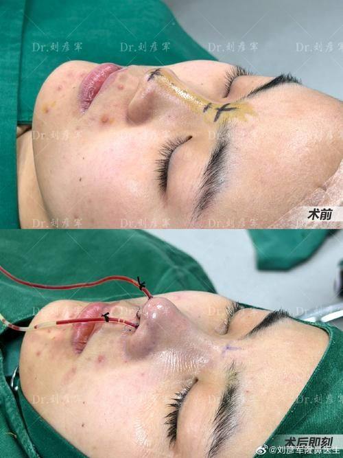 南京亚韩整形美容医院怎么样