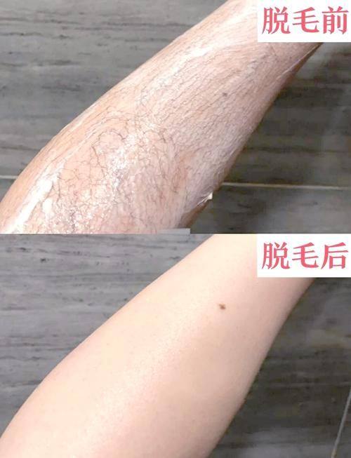 辽宁沈阳浑南蓝树医疗美容门诊部预约挂号方式：