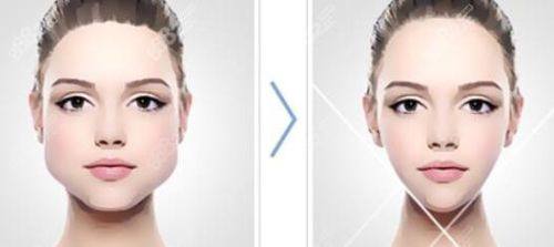 李星爱医生技术优势：