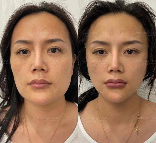 韩国济州岛slow整形外科医生名单及擅长领域：