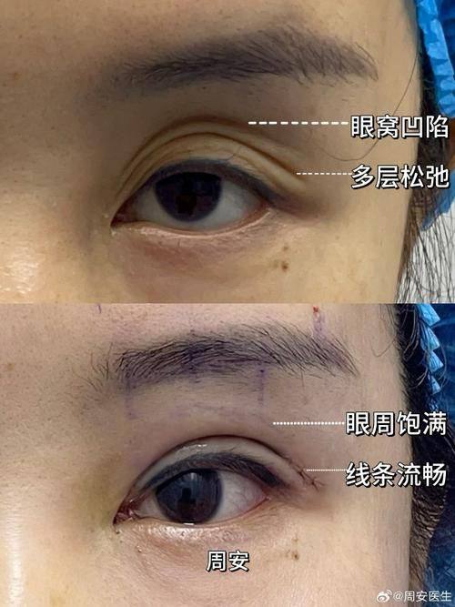 仙台Eye美容外科口碑评价