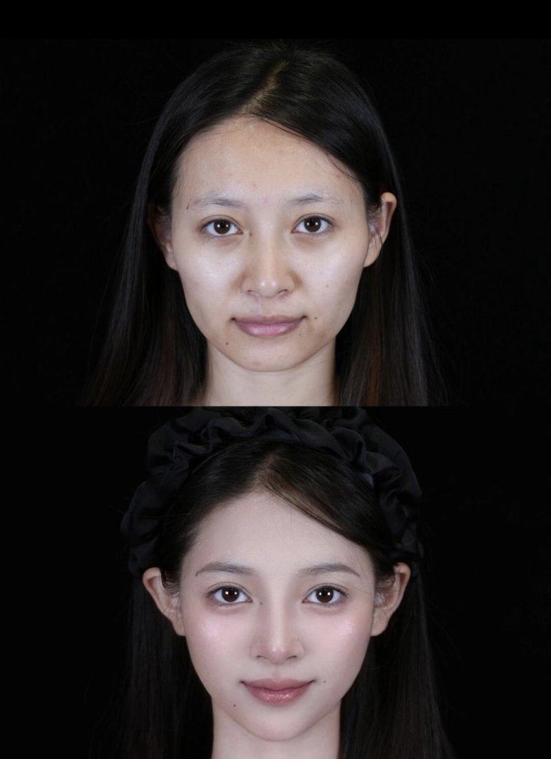 岳阳亚美医疗美容门诊部擅长项目：