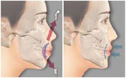 五、眼袋按摩的注意事项