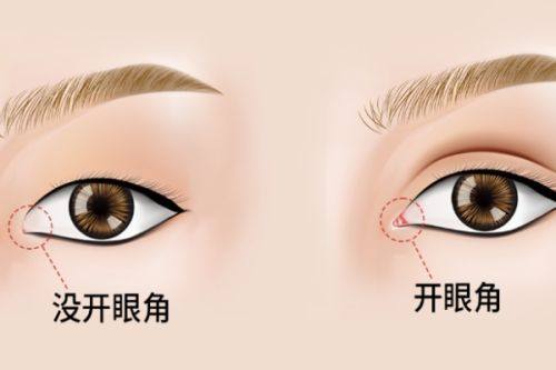 二、按摩眼睛能同时改善眼袋和黑眼圈吗