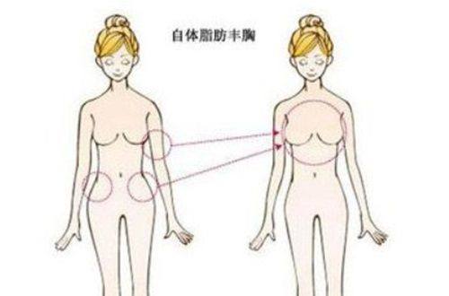 五、关于天生双眼皮消失的常见疑问（对应高频搜索问题）
