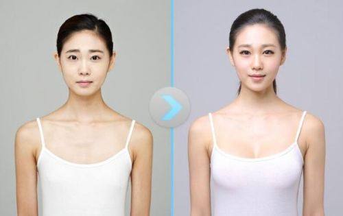 allliting整形外科口碑评价