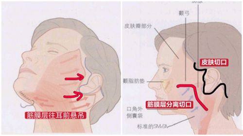 五、早干预的核心优势与实用改善方案