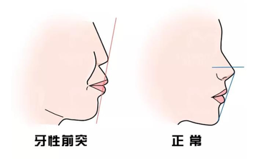 三、天生内双群体的特殊困扰