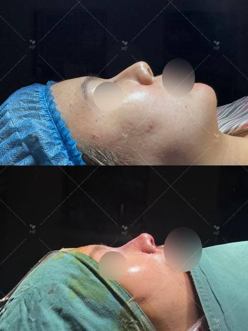 成都圣母医院整形科擅长项目：