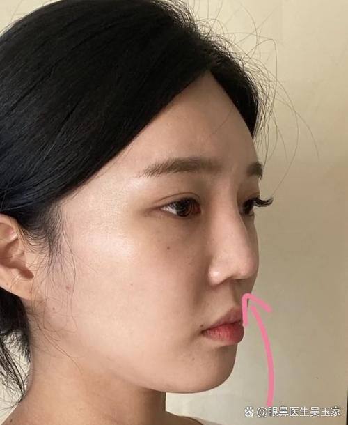 上海一美整形美容外科医院怎么样？