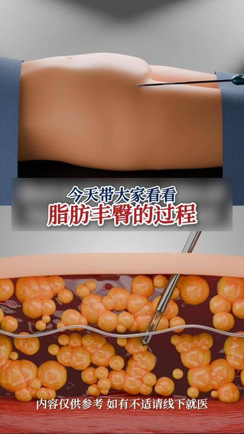 成都圣母医院整形科怎么样？