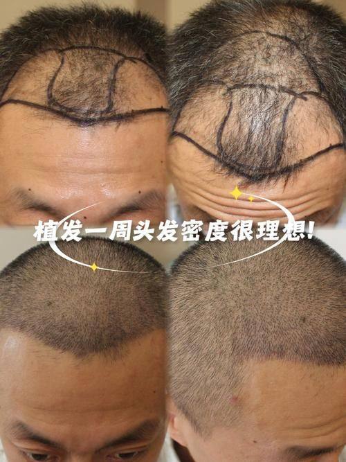 沈阳椤迪特医学美容诊所擅长项目：