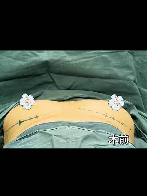 吴晓琴医生技术优势