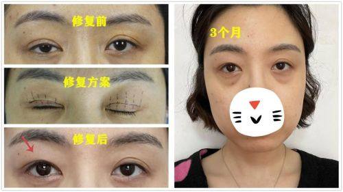 阜新安琪美医疗美容医院地址电话及营业时间