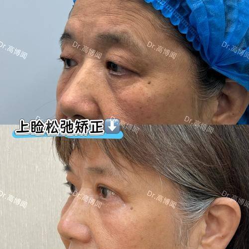 阜新安琪美医疗美容医院预约挂号方式