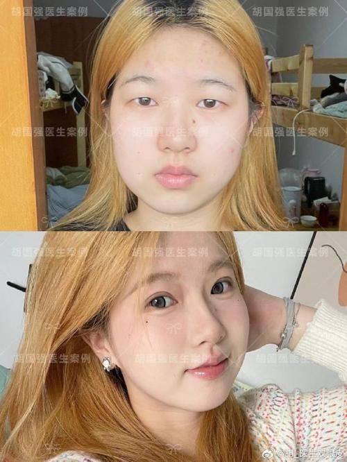 阜新安琪美医疗美容医院口碑评价