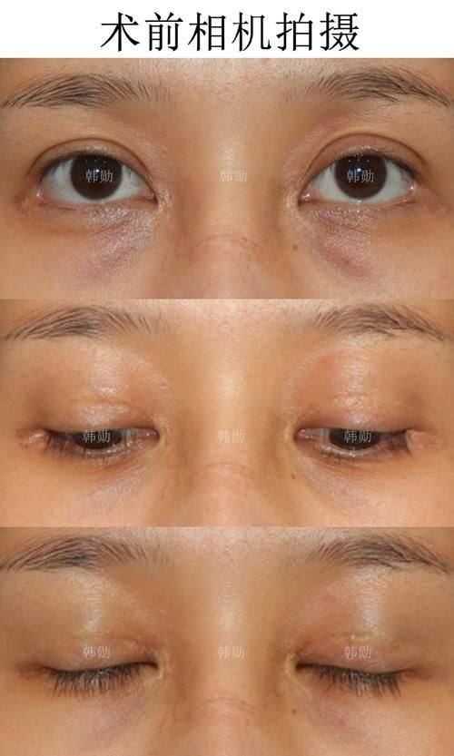 阜新安琪美医疗美容医院擅长项目