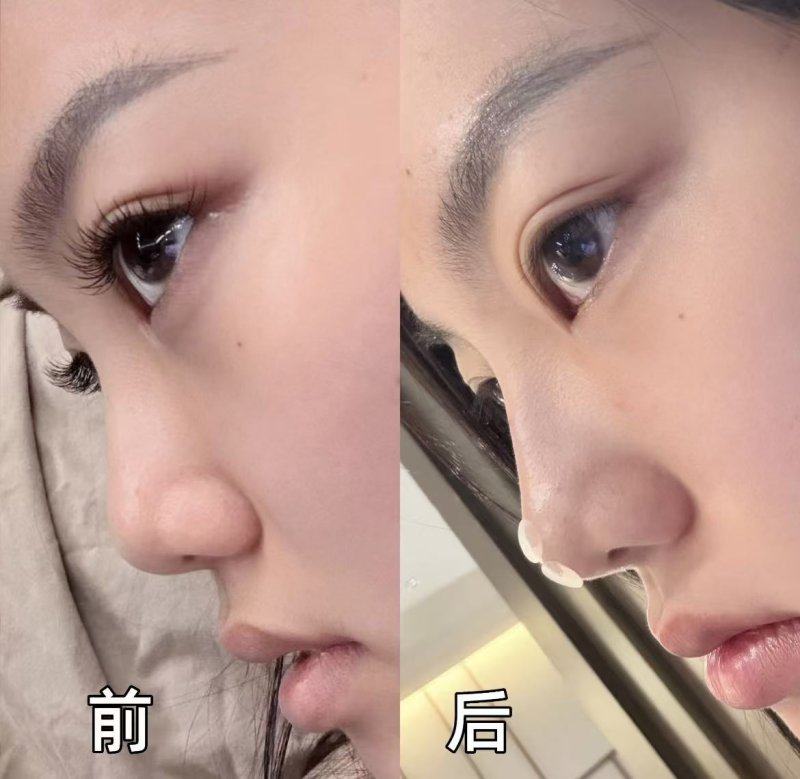 武汉民欣整形医院医生名单及擅长领域