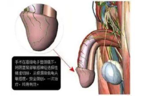 五、术前询问与时长确认的实用要点