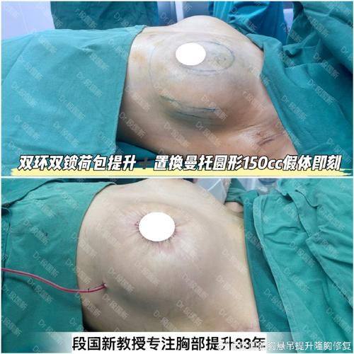 白永明医生怎么预约