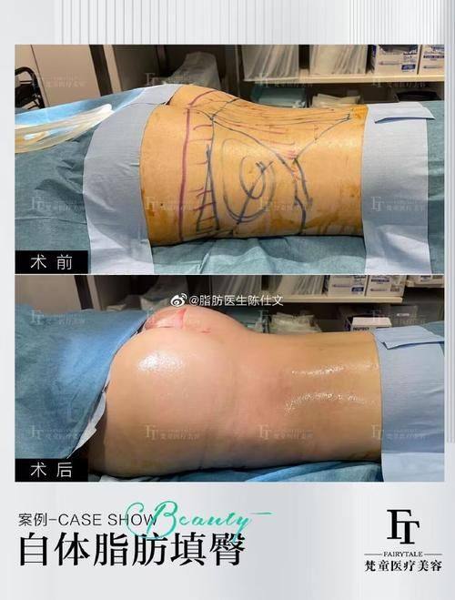 天津凤凰怡美整形美容医院怎么样？